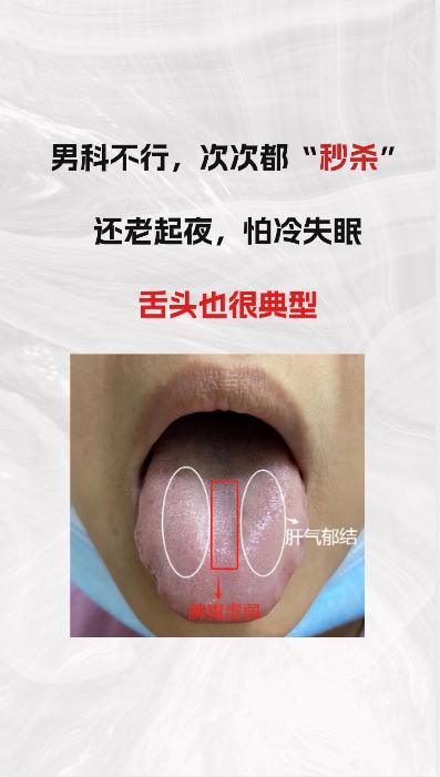 男科次次都是秒杀，还老起夜，怕冷失眠 这个舌头很典型
