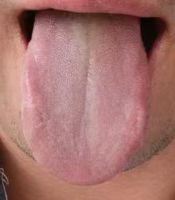 虚实夹杂如何调宗筋？清肝、补脾肾双管齐下






有位年轻粉丝发来留言，希望