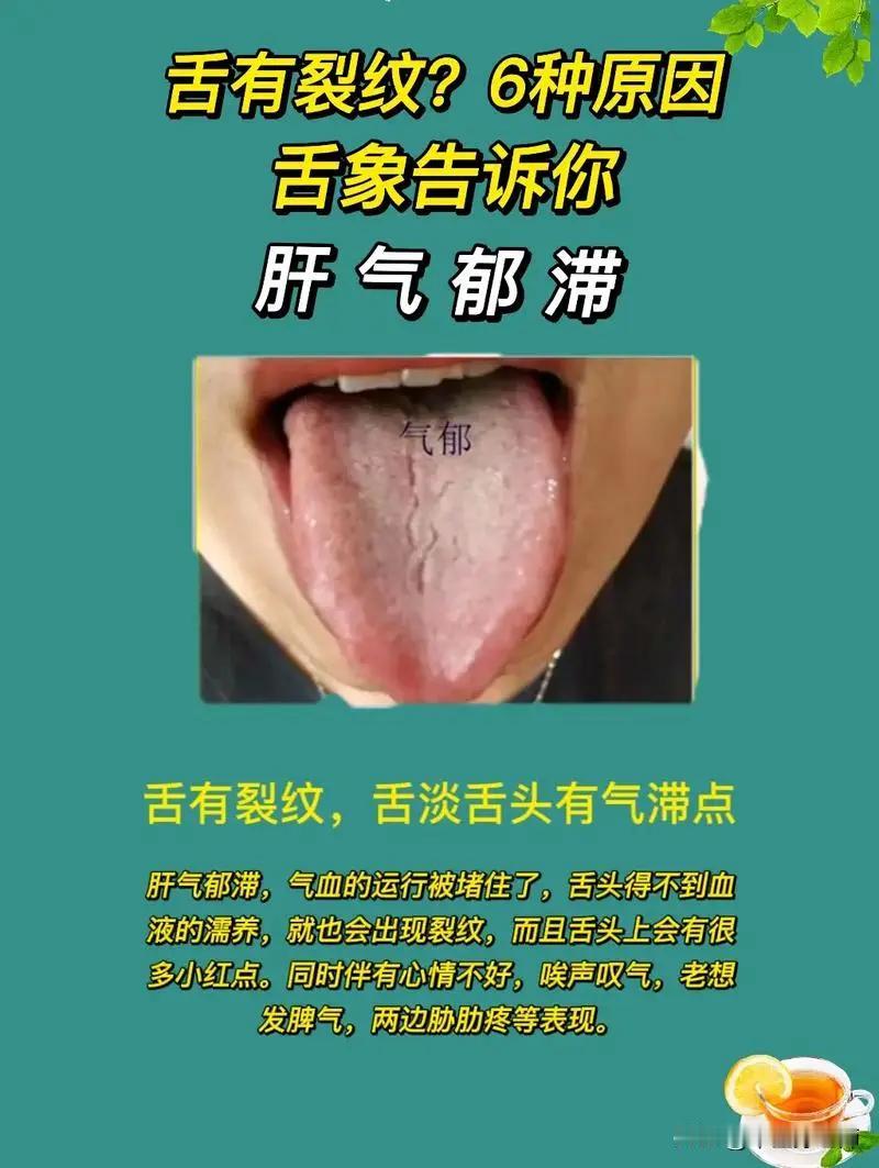 舌头有裂纹，6种原因通过舌象告诉你#健康##舌象分析#