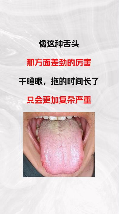 这种舌象，那方面超级差劲，关键时刻大眼瞪小眼，没办法

#中医##养生#