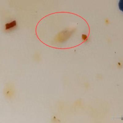 上海，女子去面馆里就餐，当香喷喷的面条端上来时，女子就开始享用。谁知道吃了一会后