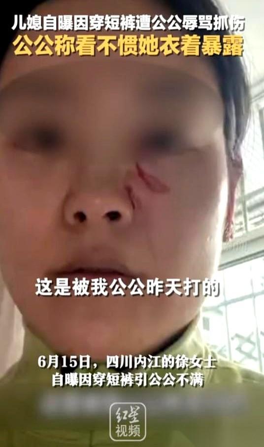 在自己家穿条短裤吃饭，换来一盆汤泼在身上，加满脸血印子。
门外是50多岁公公疯狂