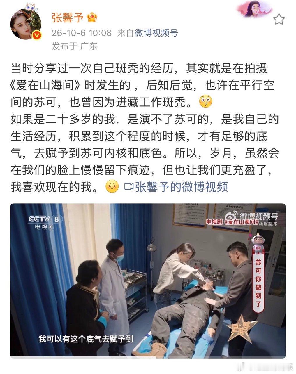 张馨予我喜欢现在的我张馨予曾经历过斑秃张馨予：我喜欢现在的我 ​​​