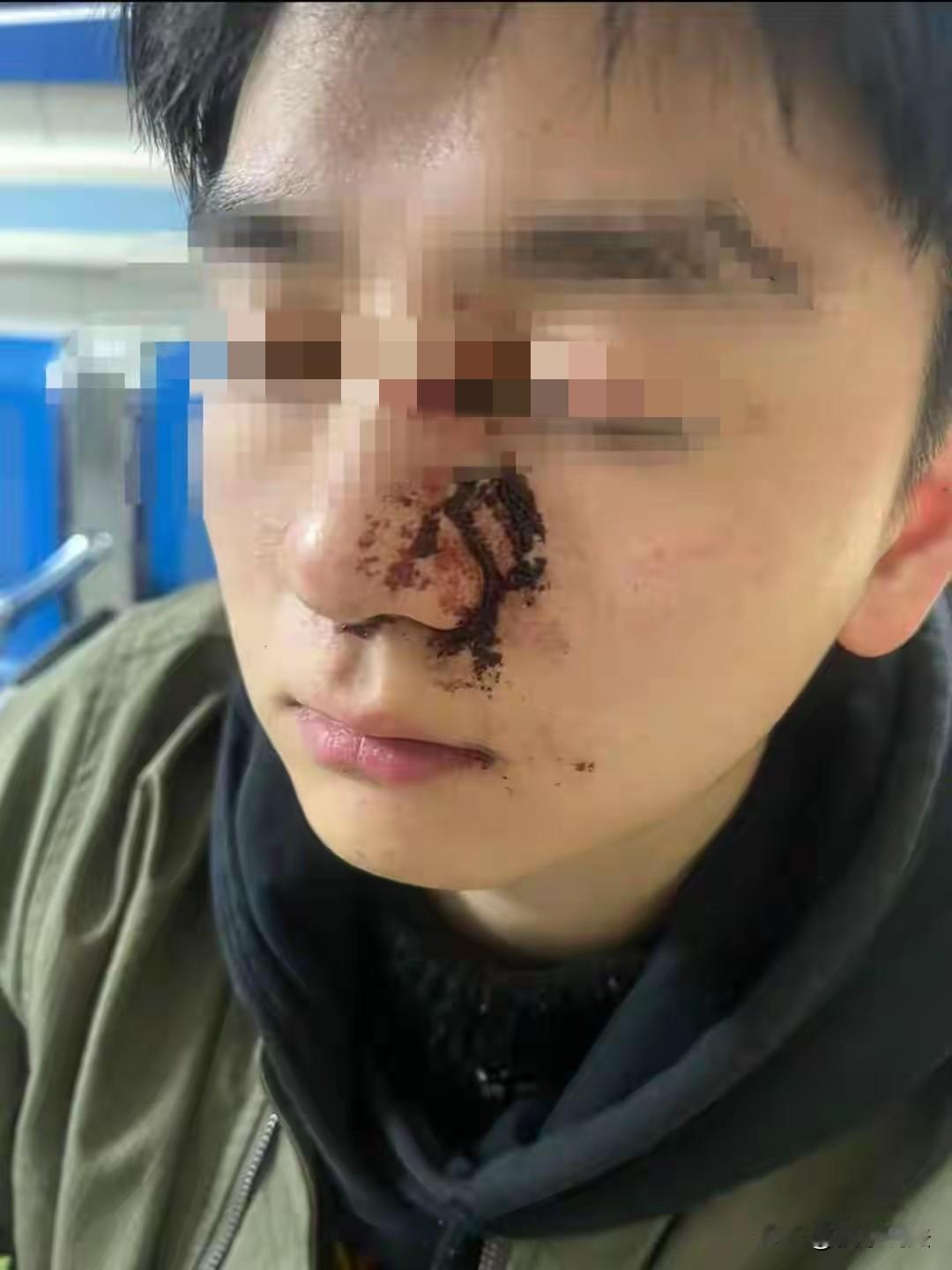 “判轻了？”重庆，女子领着未拴绳的“哈士奇”狗突然冲向一男子，男子逃跑时一下摔倒