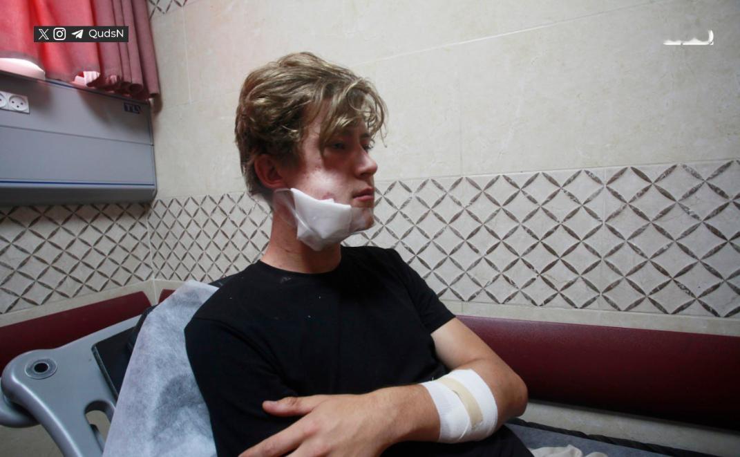 7月21日，大批以色列右翼武装民兵，犹太人定居者暴徒，在巴勒斯坦约旦河西岸地区，