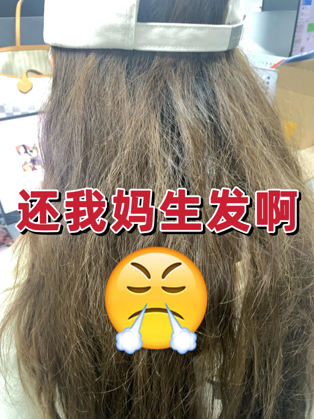 无良tony，还我妈生头发