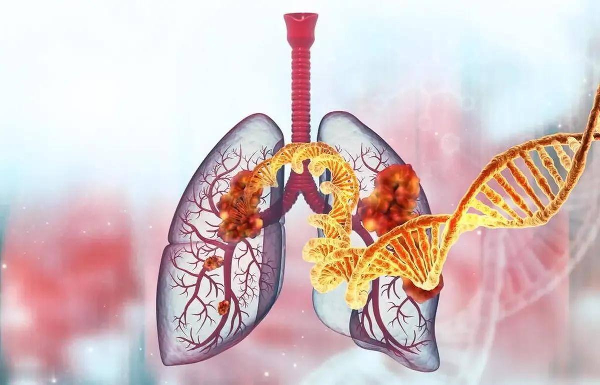 肌炎引起肺疾病，不死也会蜕层皮，有些病毒感染还会加重病情
今天有个人在网上咨询我