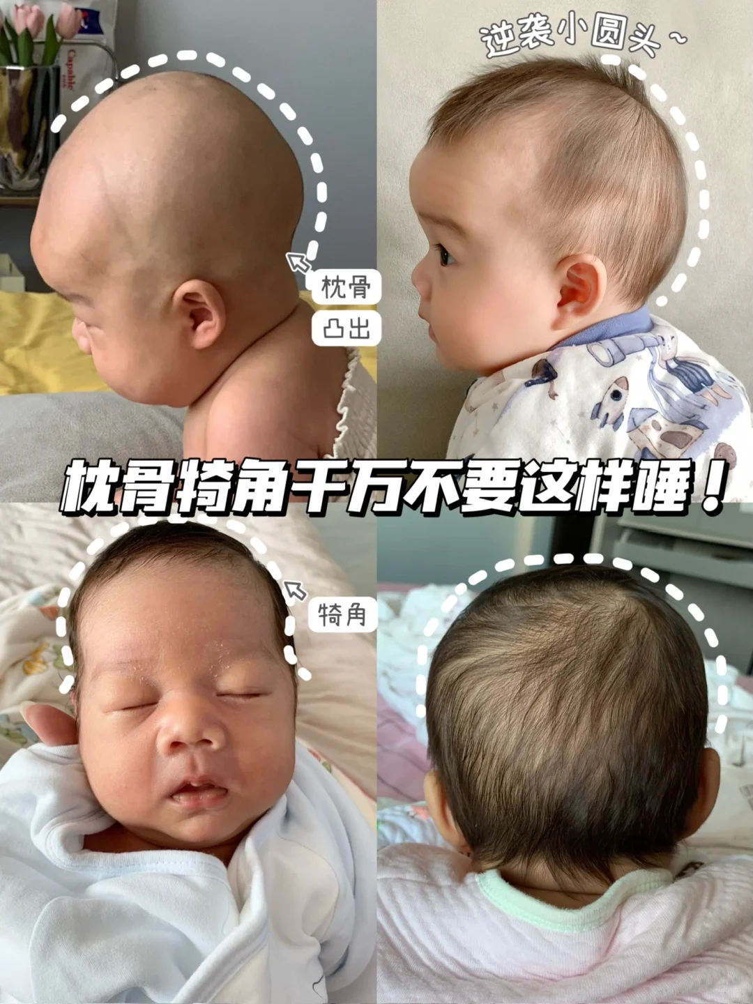 关于枕骨犄角！睡圆头一定要避免这些错误！