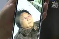什么样的儿媳妇，竟然把婆婆打成这样？

7月初，浙江嘉兴发生一起家庭暴力案件。