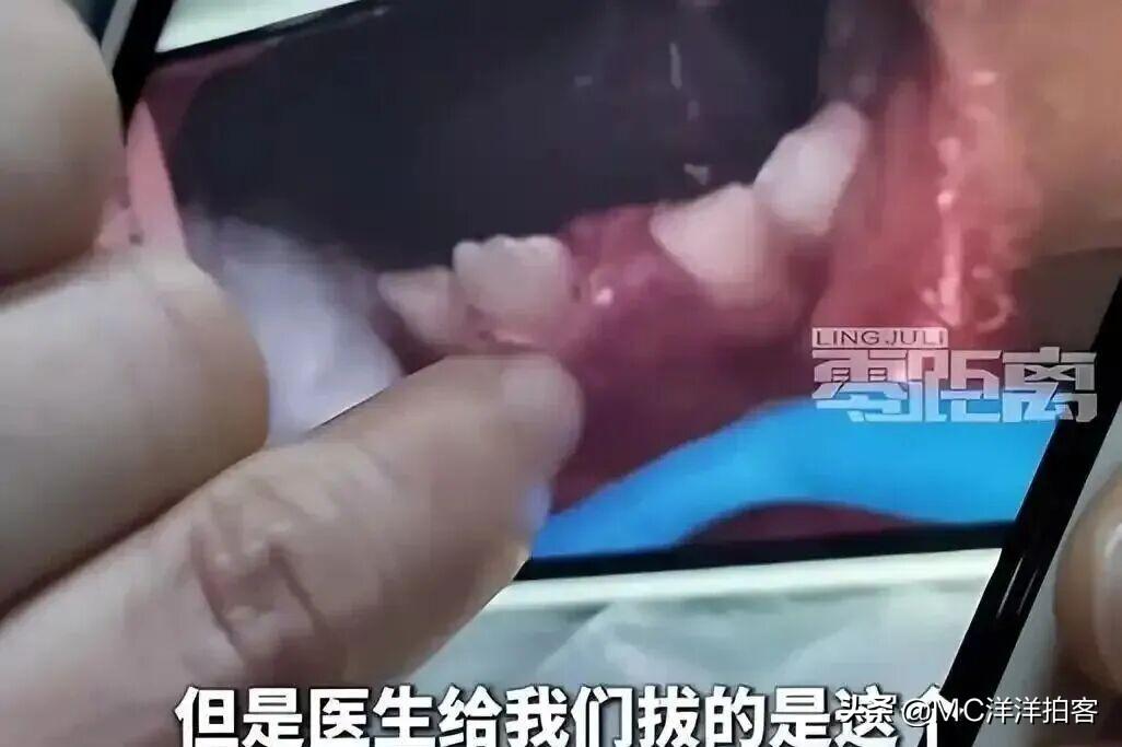 【触瘦！盐城一医生违规执业被立案调查！】近日，盐城6岁男童因乳牙未脱落，前往束世