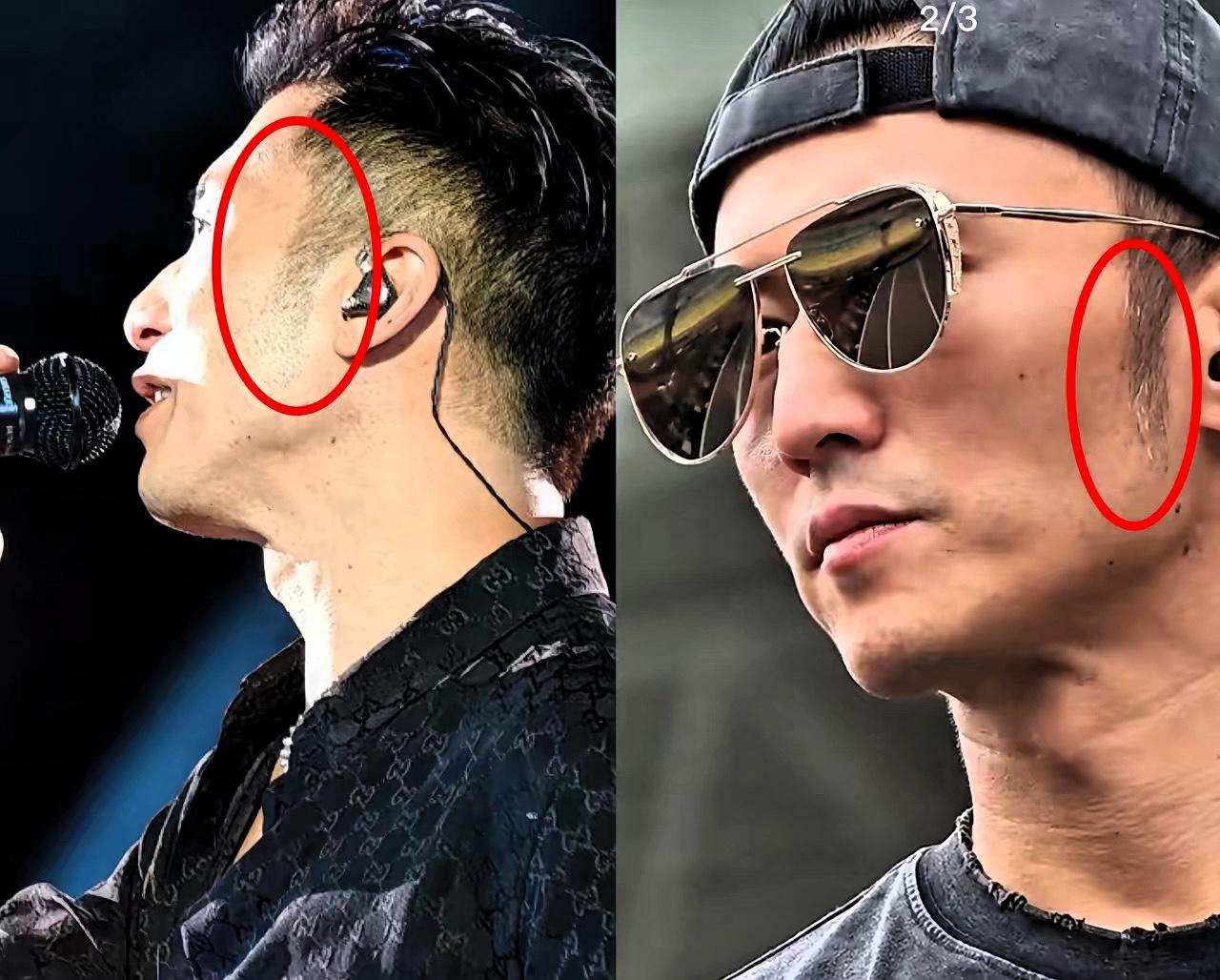 谢贤去世后，
这是谢霆锋第一次露面，
他看起来不太对劲，细心的网友发现，他的鬓角