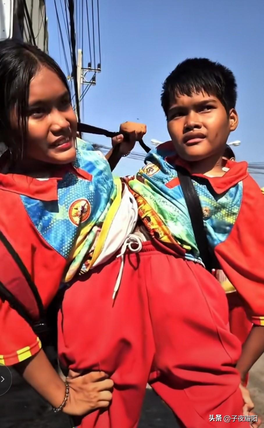 兄妹共用一双腿，这是印尼一对普通家庭的连体兄妹，从生下来后就一直备受外人的歧视，