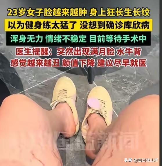 太悲催了！广东，23岁女生喜欢撸铁，不料，撸着撸着，不仅脸越来越肿，身上更是狂长