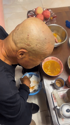 近日天津，女子父亲出去剃头，回来后竟然顶着满头伤口，女子赶紧凑近看，父亲的头上密