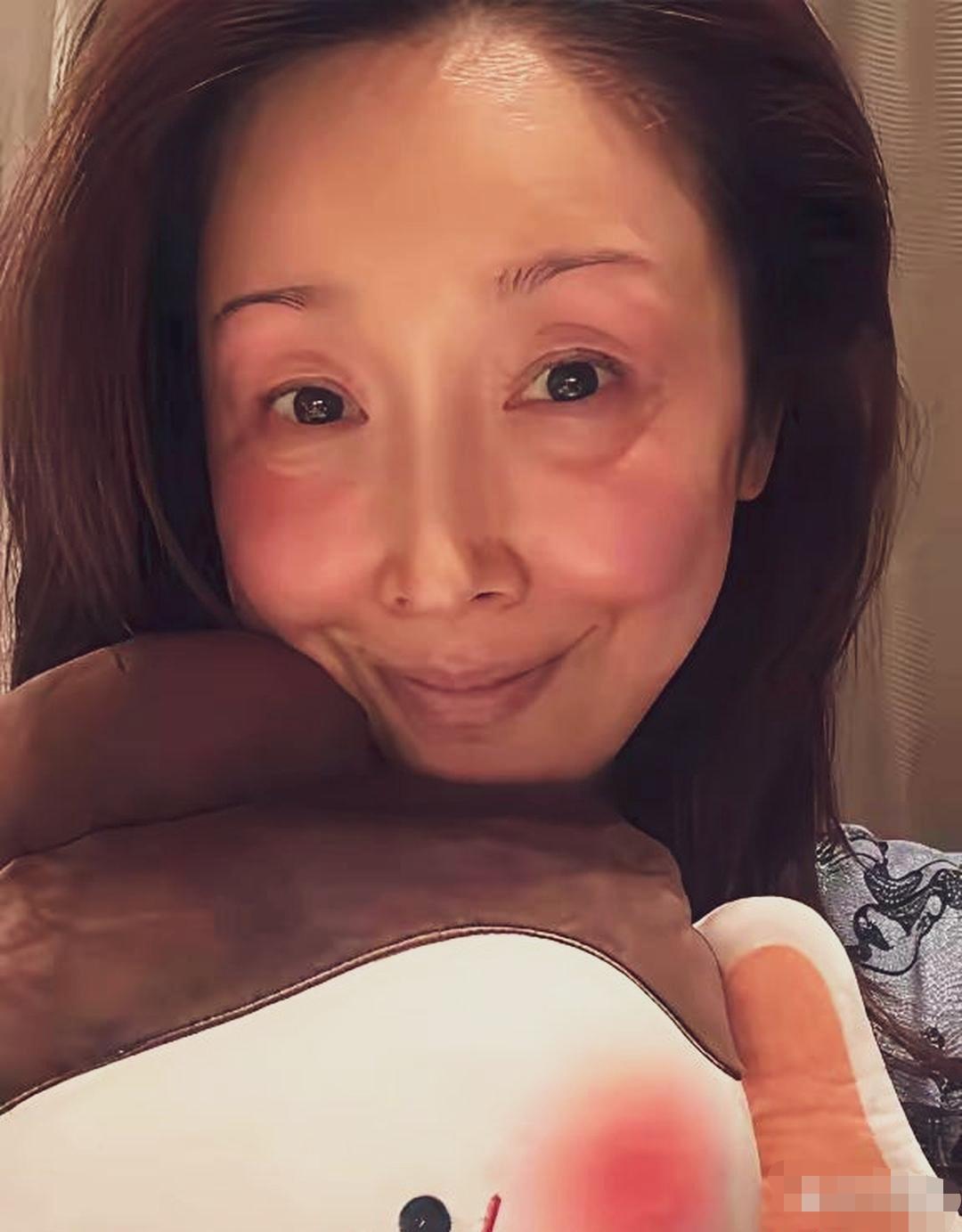 孙悦半夜发自拍，脸颊、眼周大面积泛红，两腮红的透亮。不会是喝高了吧？