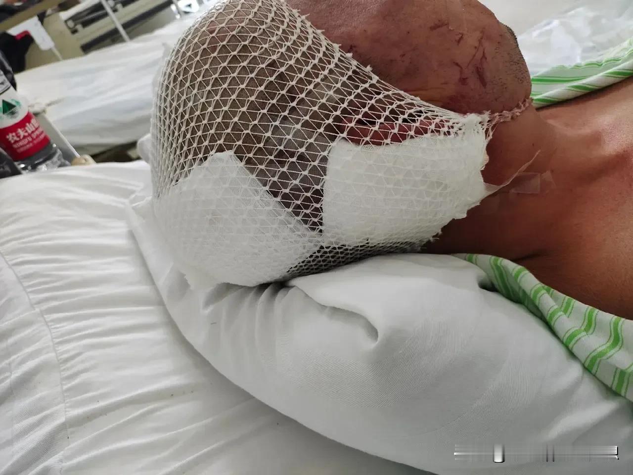 河北廊坊燕郊一临街的炸鸡店发生爆燃事故，事故已导致2人死亡，26人受伤。一名亲历