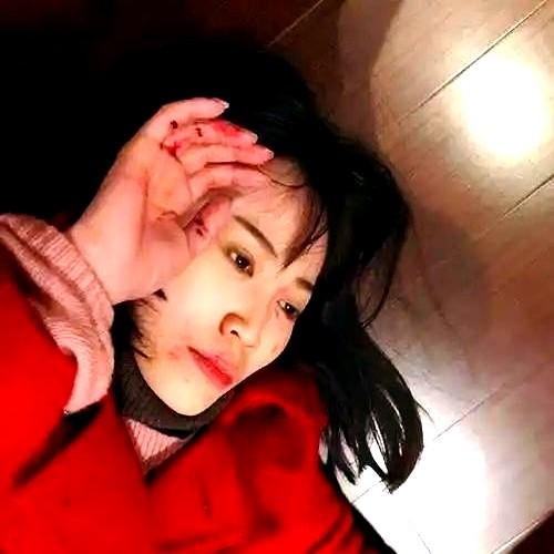 对不起，实在没忍住！

刷到马蓉曾自导自演被王宝强打的照片，被识破后狼狈逃窜的场