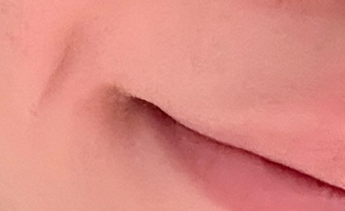 为啥笑起来嘴旁边会有颗米