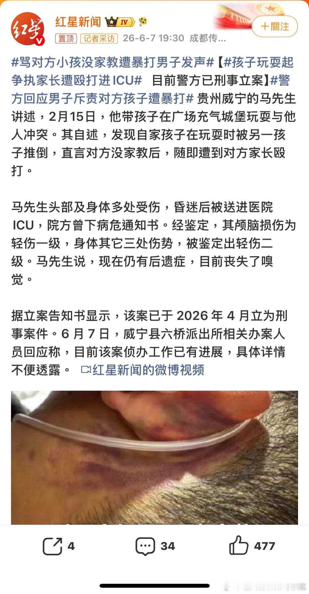 笨蛋，為什麼要幫人家教牲口呢？人家打你儿子，你氣不過，也不必去教人家的牲口吧，世