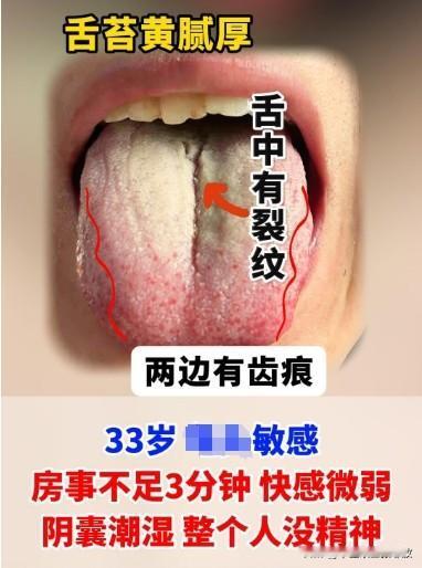 舌头裂的不像样，舌苔黄腻腻，偏偏舌尖火红，这种调起来才是真棘手[狗头][狗头]
