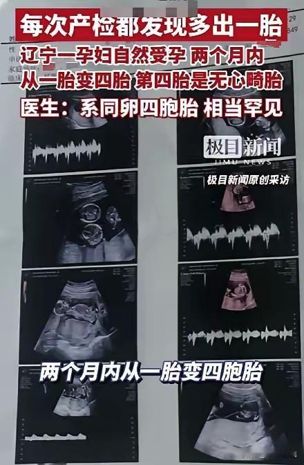 辽宁有个孕妈，自然怀孕去产检，一开始医生说就一个宝宝，结果每次检查都多一个，俩月