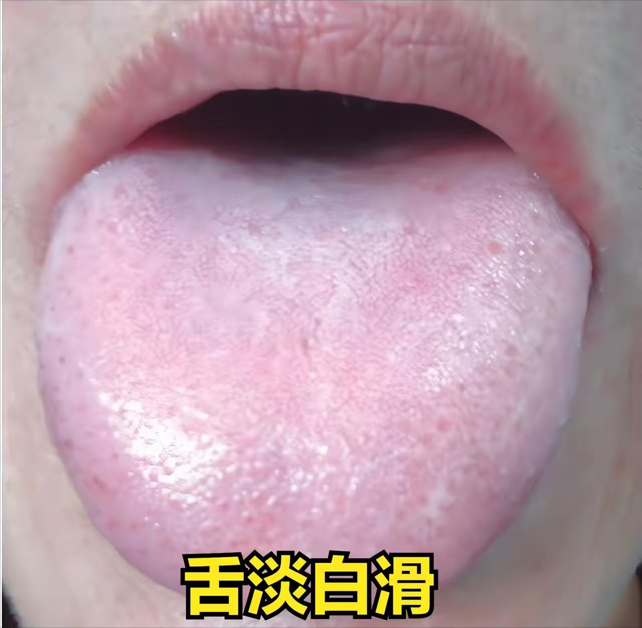 五一小假期继续看舌，利用休息时间，我会仔细查看，绝不遗漏，只需一分钟，我就能告诉