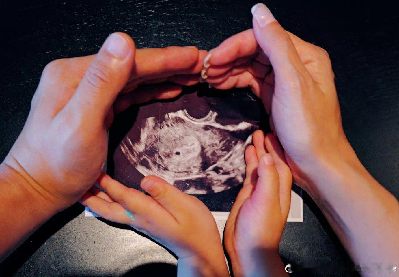 卢靖姗韩庚又有一个baby要在爱中降临啦[爱慕][爱慕][爱慕] ​​​