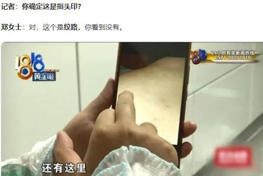 “想白嫖想疯了？”杭州，35岁女子被班长轻轻拍了下后背，结果她1年没法上班，说被
