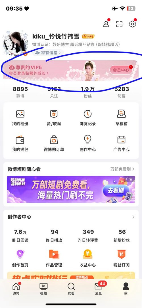 这个什么时候弄掉啊。好丑 ​​​