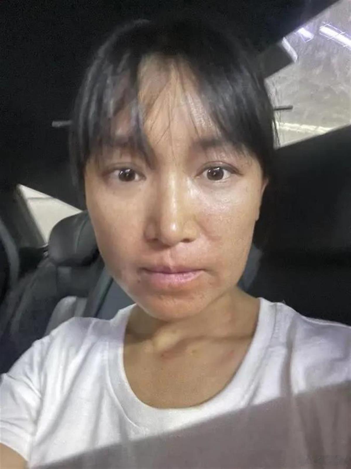 李子柒携雕漆隐花 ，复出过敏画面曝光， 学艺工艺厂100人里，99个都过敏，她学