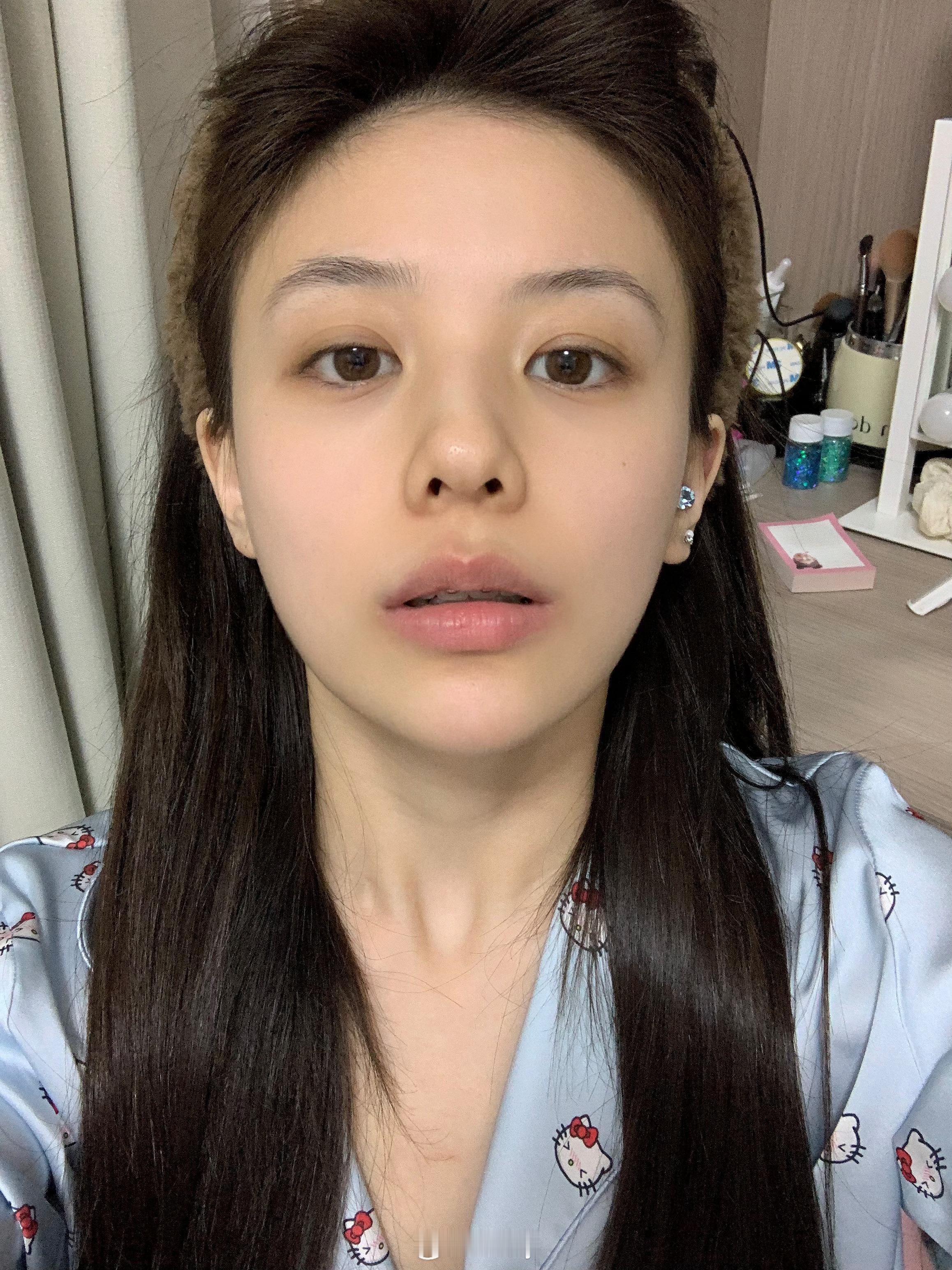 这段时间真的在好好护肤！！（给自己鼓掌）好好休息加上一直用眼霜！！我的黑眼圈！蒸