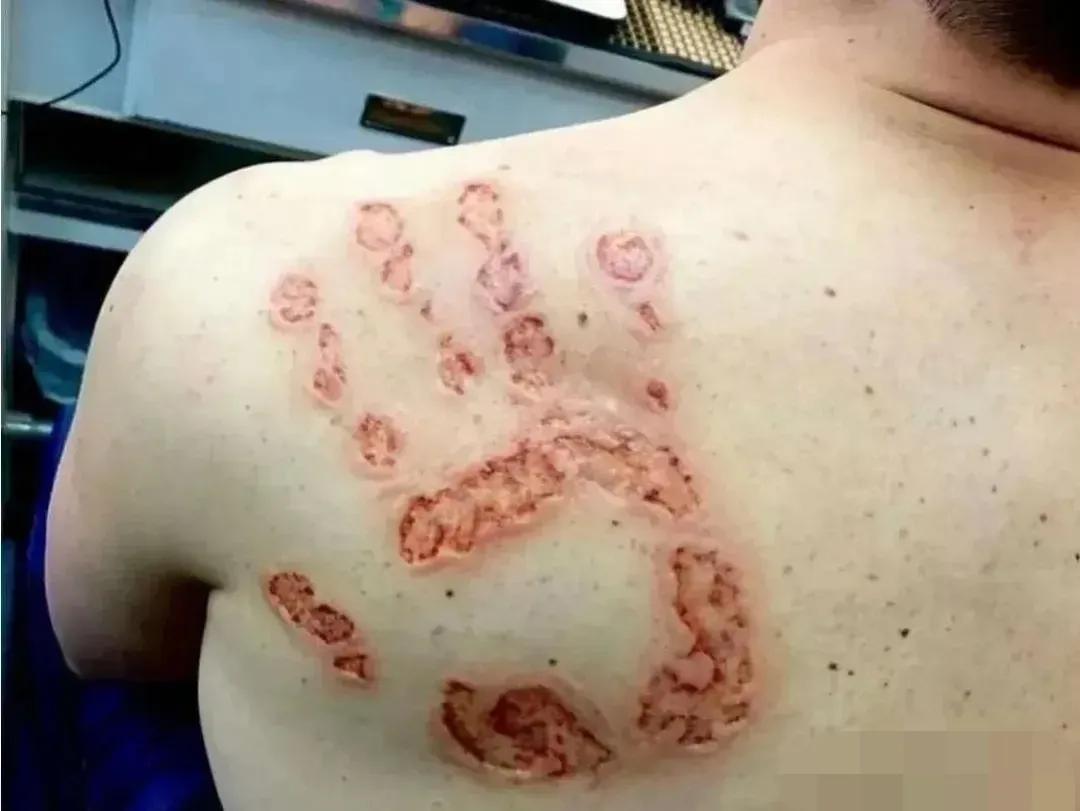 这巴掌有毒吧[捂脸][捂脸][捂脸]
