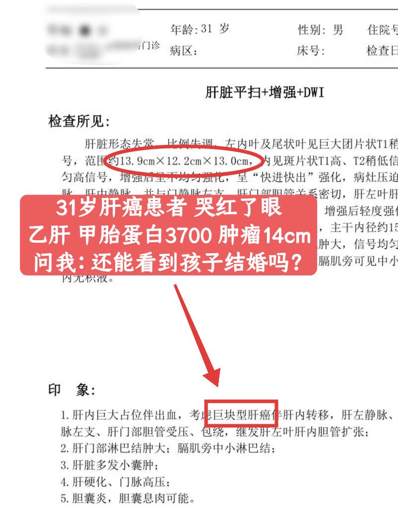 “教授，我才31岁，怎么就肝癌了？孩子才上1年级，我要是没了，这个家就...