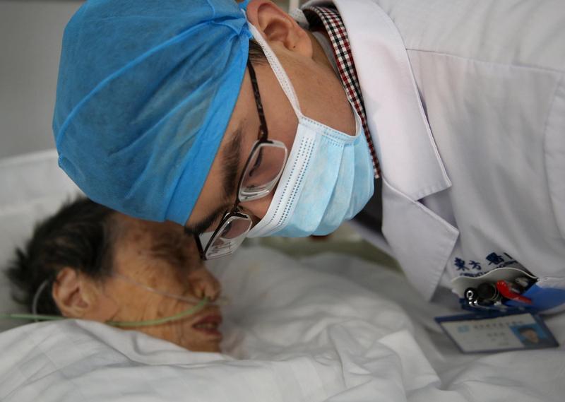 最近看到两则男子喉咙痛迅速恶化进ICU的新闻，太吓人了。
陕西西安的张先生，就诊