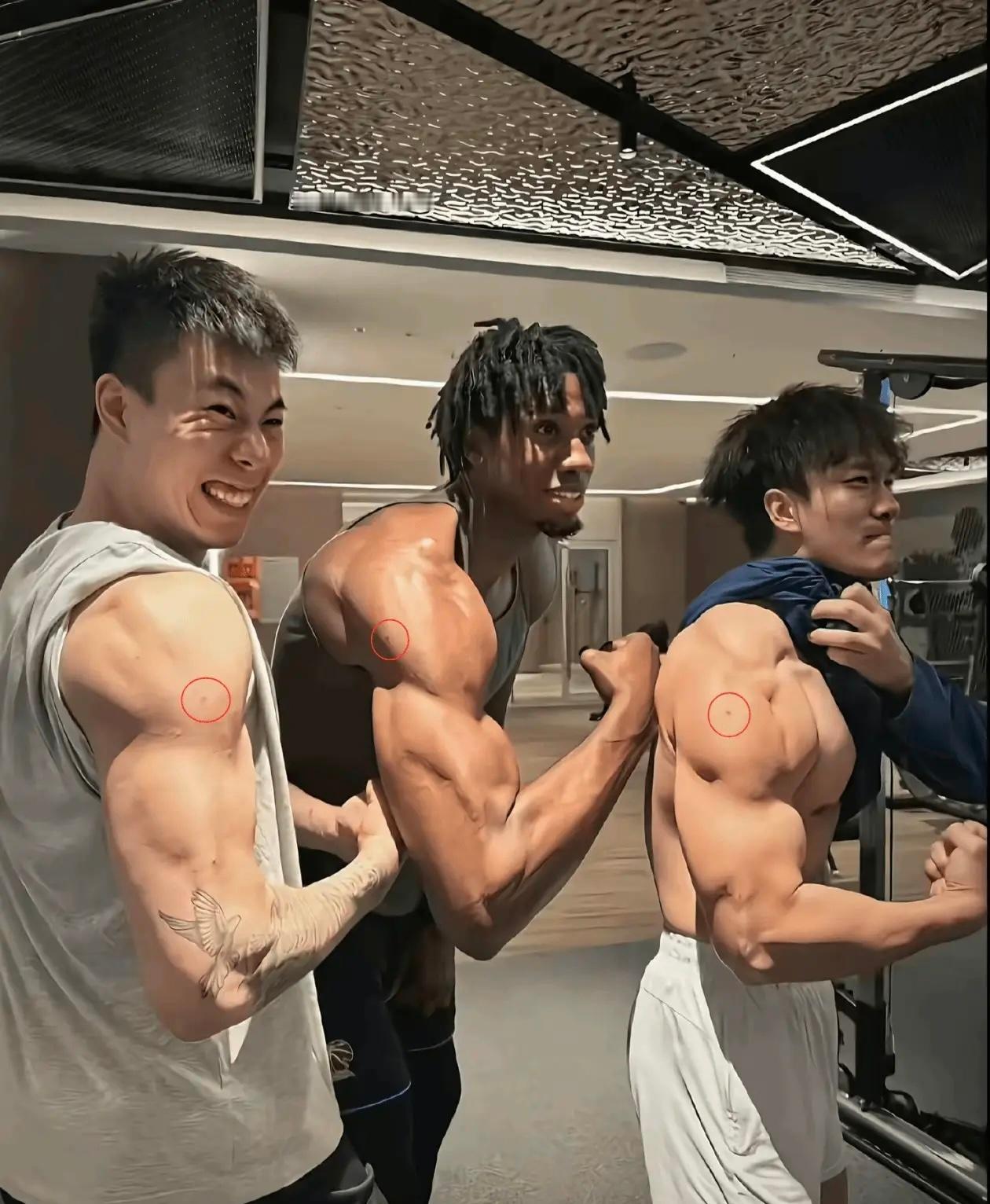 有没有打过类固醇的人来看下，这三人在同样的部位是不是有针口？ 