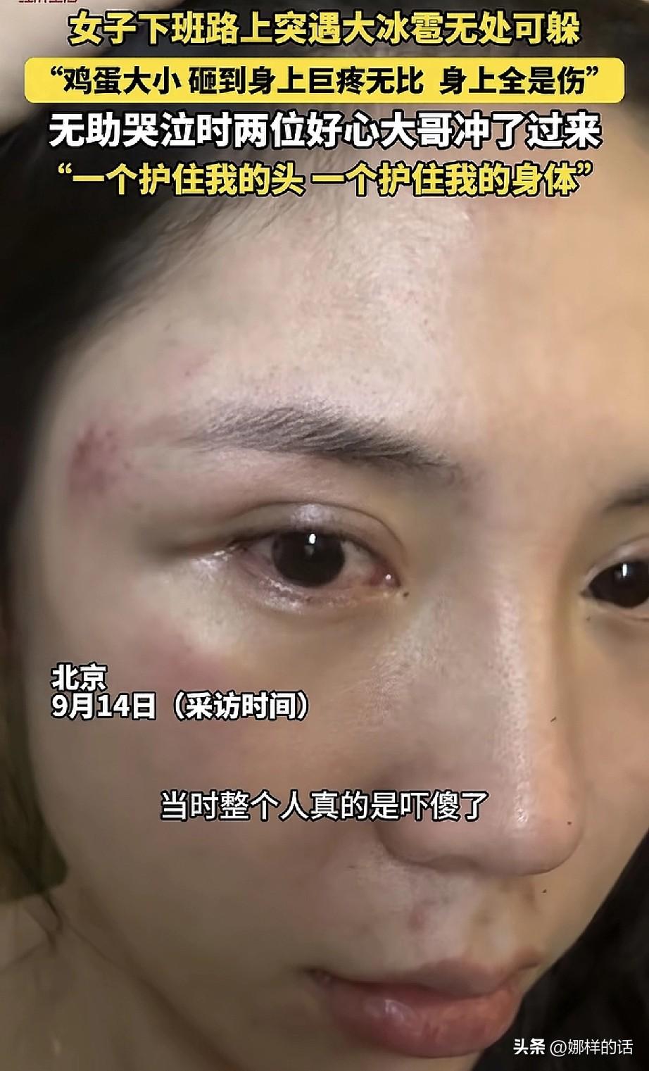 “姑娘别怕，我们送你回家”，9月13日晚，北京的一场冰雹将一女子困在了下班的路上