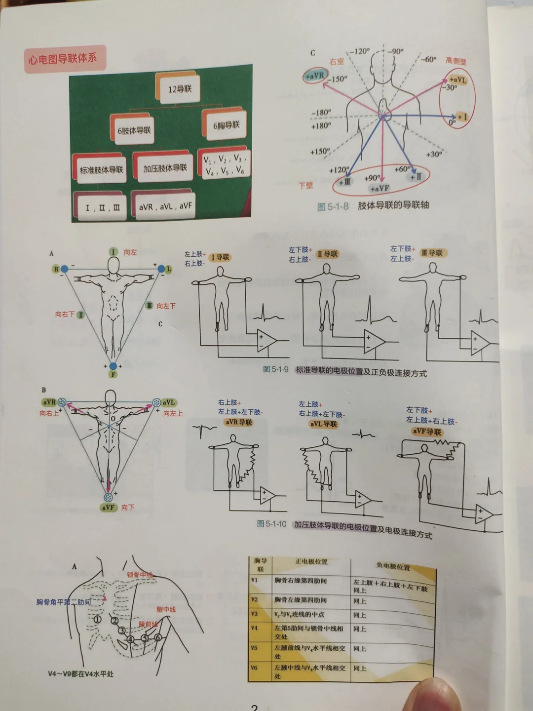 心电图诊断笔记实战