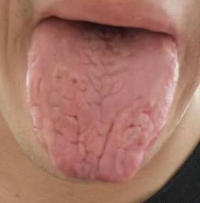宗筋状态欠佳，多因脾肾阳气亏虚







近期有粉丝前来咨询，坦言自身宗筋自