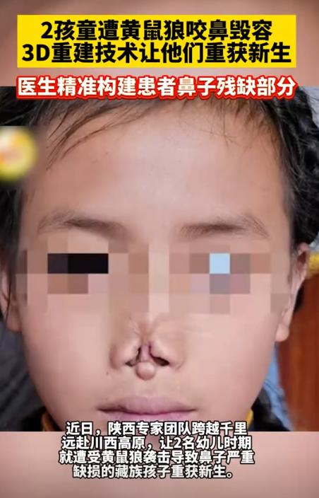 “这才是真正的专家！”四川甘孜，两名牧民的孩子因为小时候睡觉时，父母没有注意而被