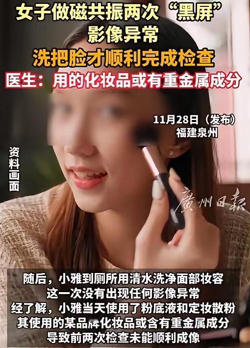 现在的化妆品质量真让人担忧。

11月21日，29岁的泉州姑娘小雅因头晕去做头颅