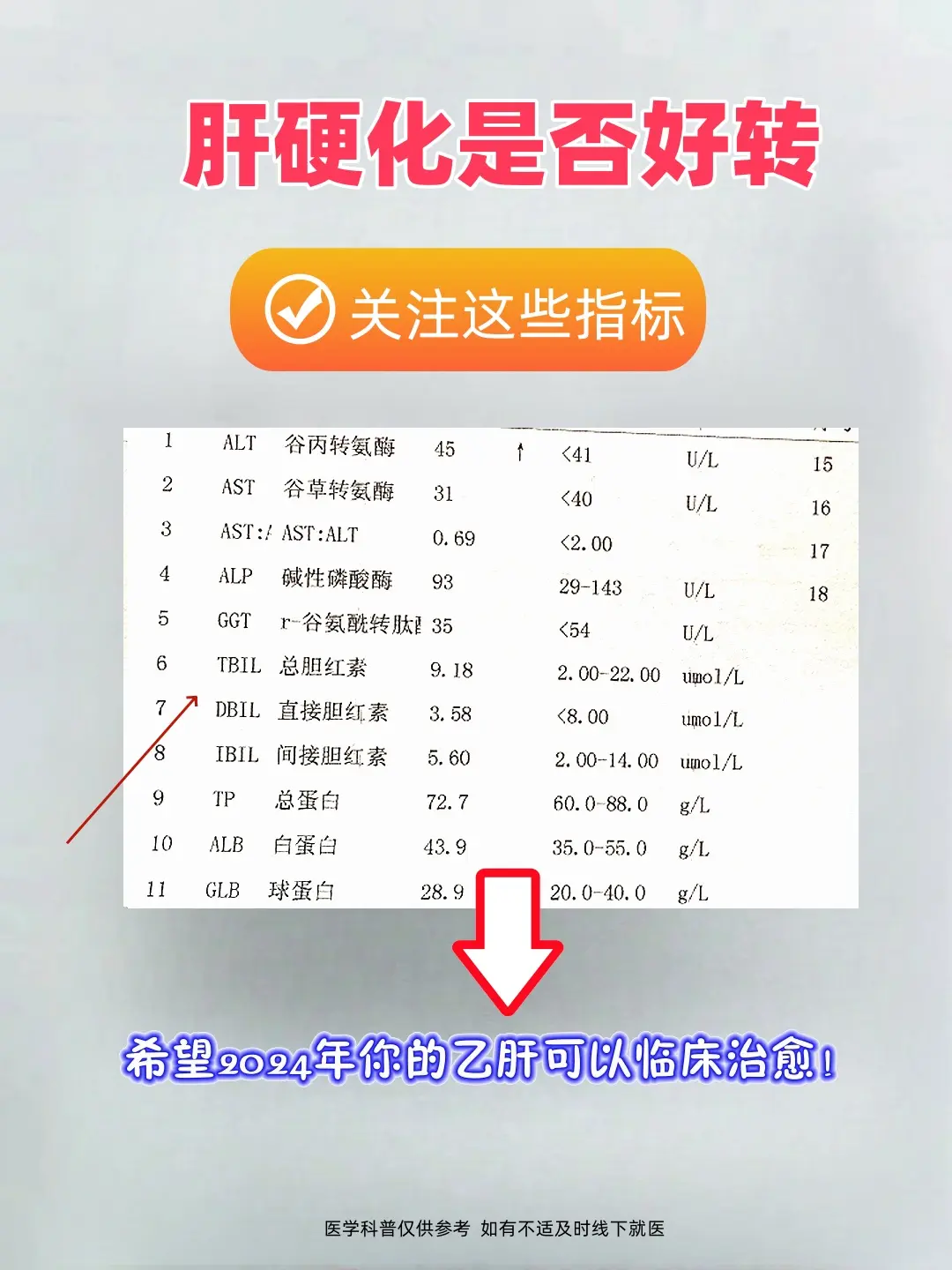 出现这些指标，说明肝硬化在好转！ 第一、肝功能指标。如果这些指标逐渐趋...