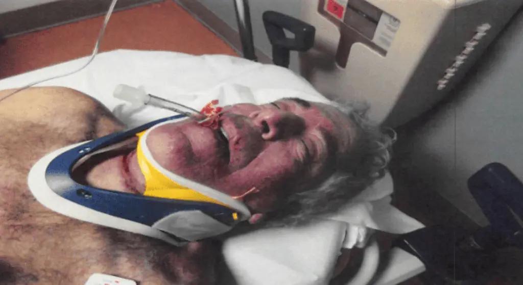 爱泼斯坦自杀后照片首度公开！ 
此前未曾公开的爱泼斯坦死亡后的遗体照片以及其在狱