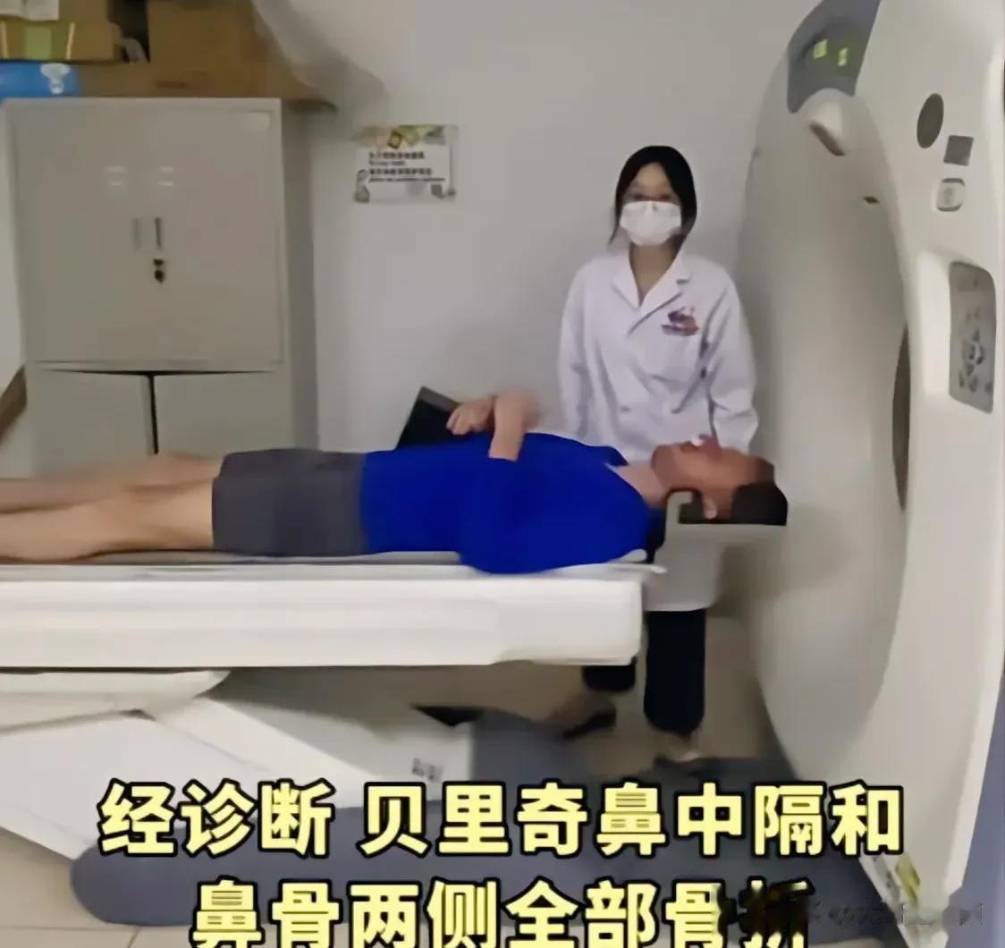 不论贝里奇骨折有多严重！对于贝里奇的处罚必须得补上，否则有失公允，估计高洪波得头