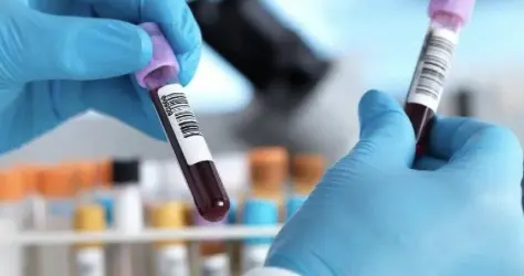 科学家20年首证：你吸入的每一口二氧化碳，都在悄悄改变血液成分