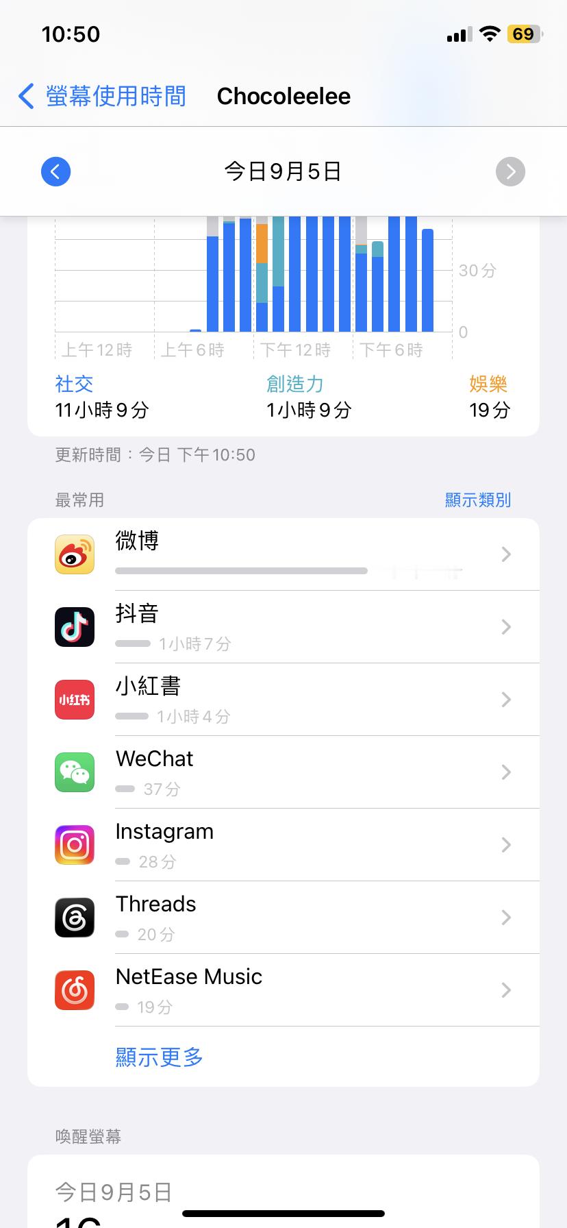 我对大眼依赖程度： ​​​