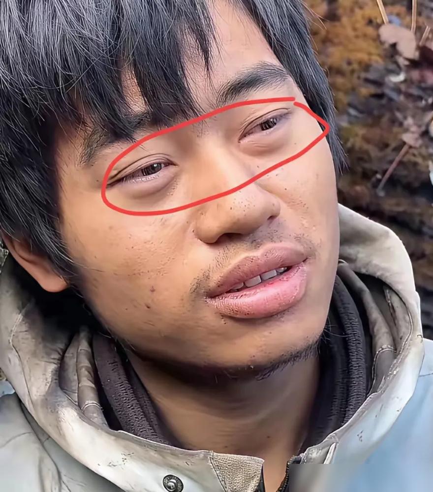 荒野求生30天，选手们快被缺盐逼疯了！连懂从植物昆虫取盐的医学生林北，都熬出重眼