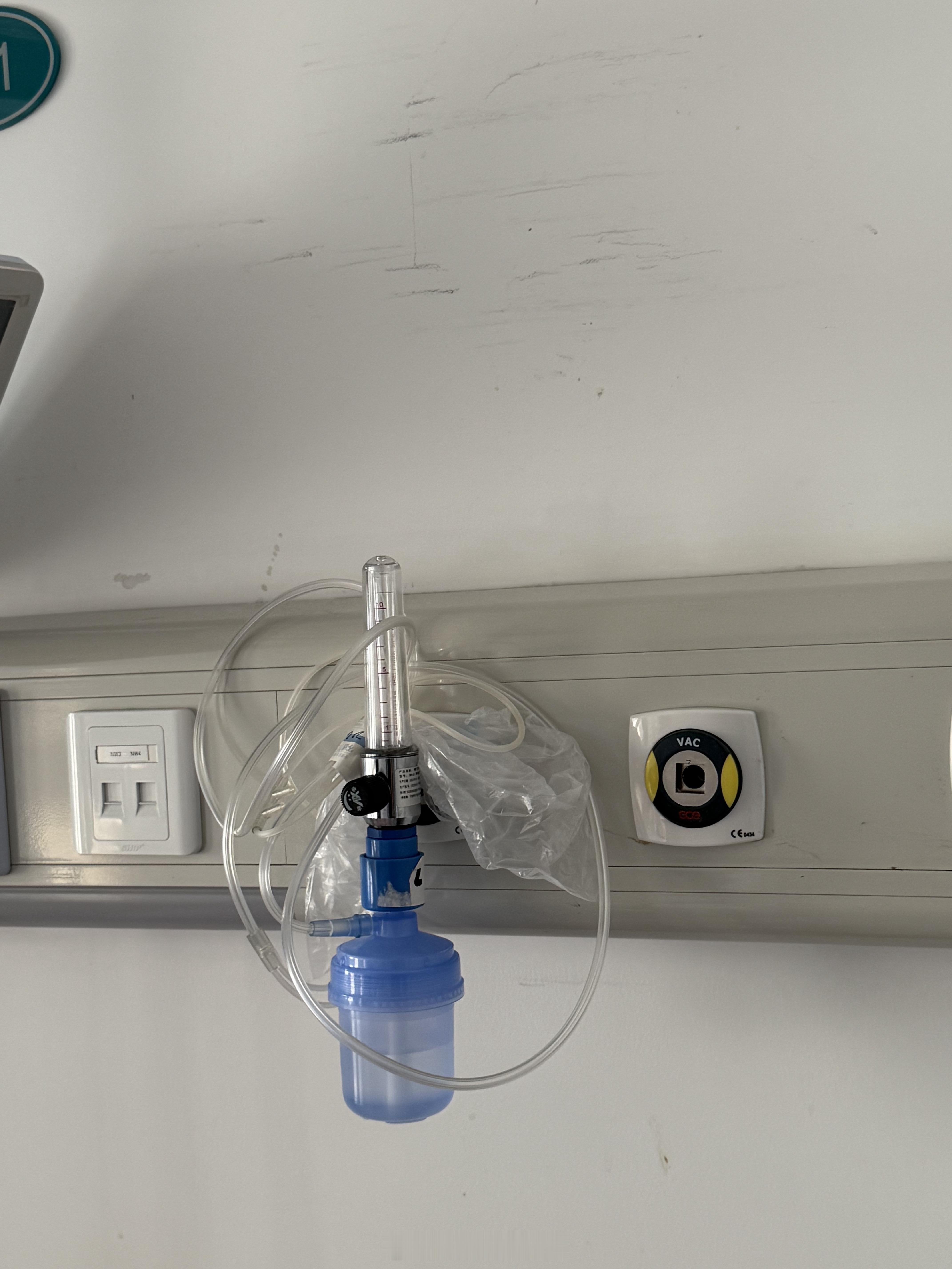 女子得了流感硬抗3天变白肺 最近家属一直在住院有时间好好说一下乙流的症状和注意情