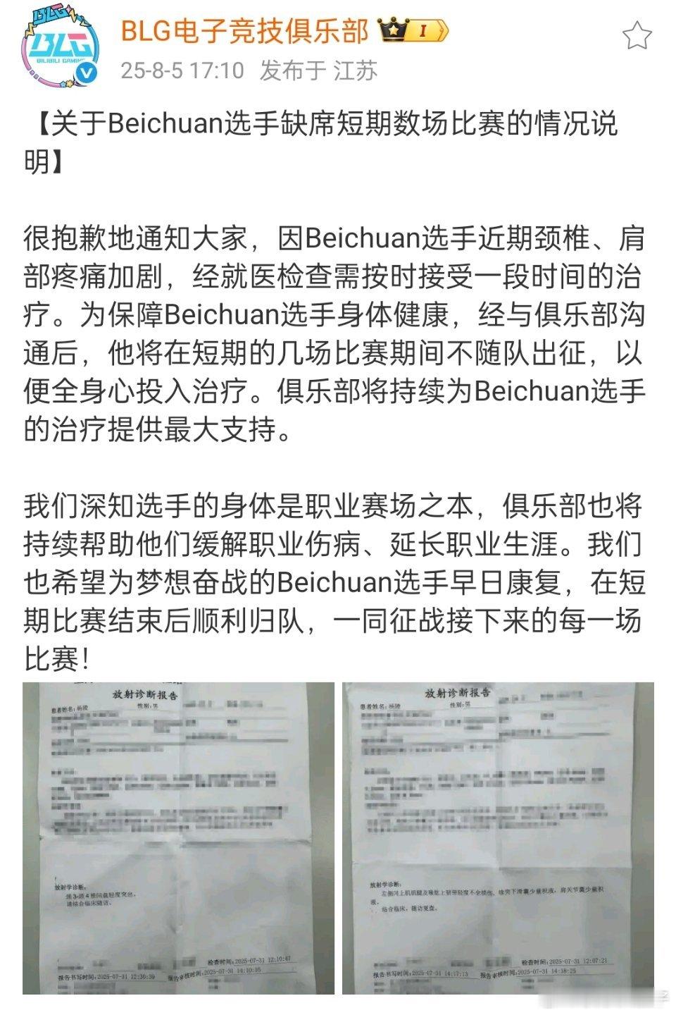 BLG公布Beichuan诊断报告 不开玩笑肩颈疼起来真的很难受。我的脊椎就有问