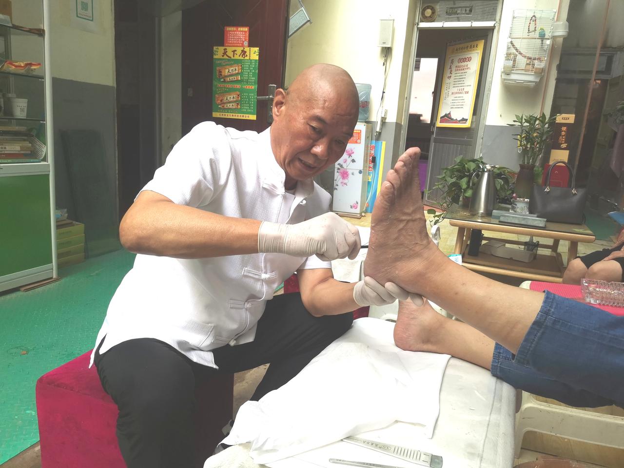 脚上雕花的修脚师李宝明

大西北网讯：记者王志俭（穿石）文图

兰州小西湖中医经