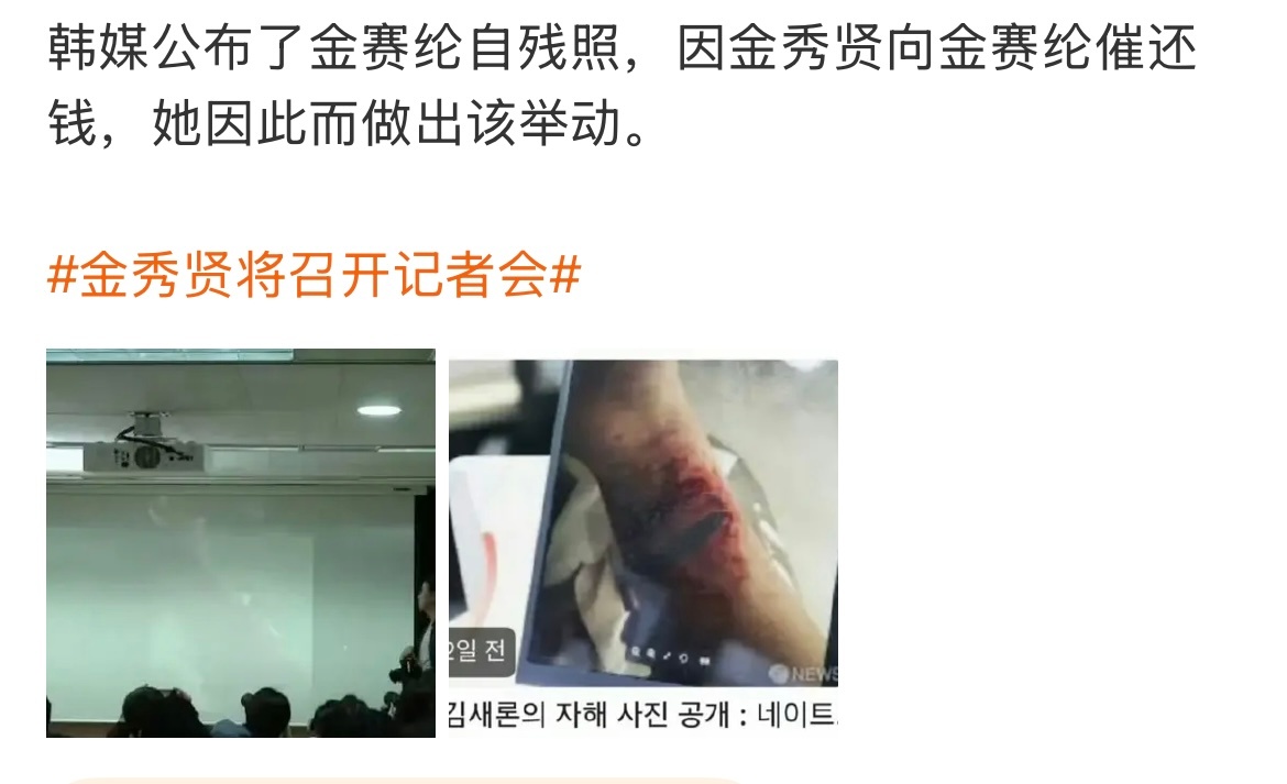 金赛纶曾因金秀贤做出自残举动 韩媒曝光了因为金秀贤催债导致金赛纶自残的图片，天呐